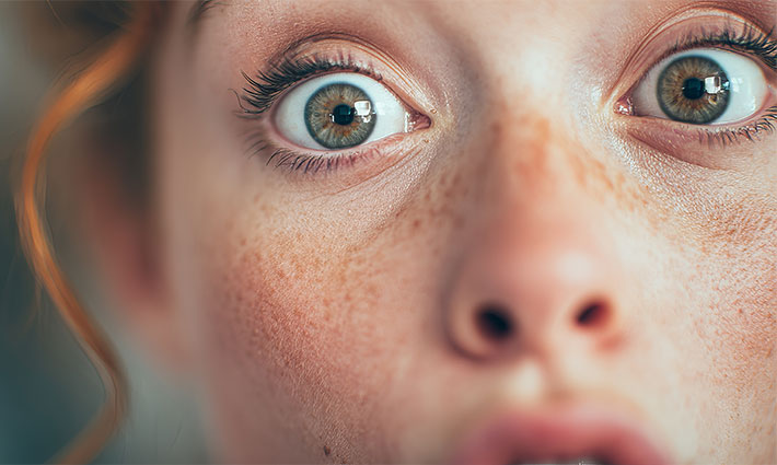 Hemangiómák a bőrön – Mitől alakulnak ki, és hogyan érdemes kezelni őket?