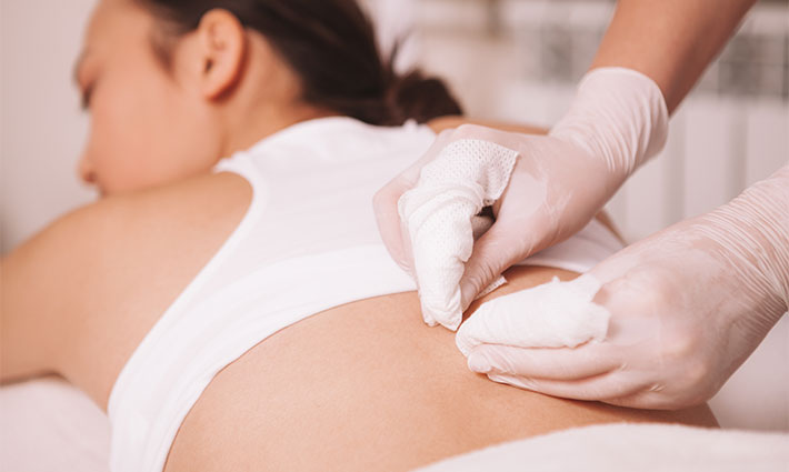 Pattanások a háton, a vállakon és a dekoltázson – Hogyan szabaduljunk meg tőlük?