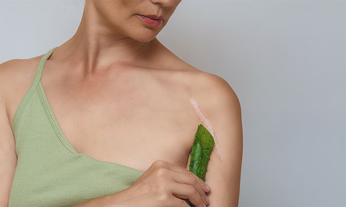 Hogyan ápoljuk a hegeket, hogy begyógyuljanak?