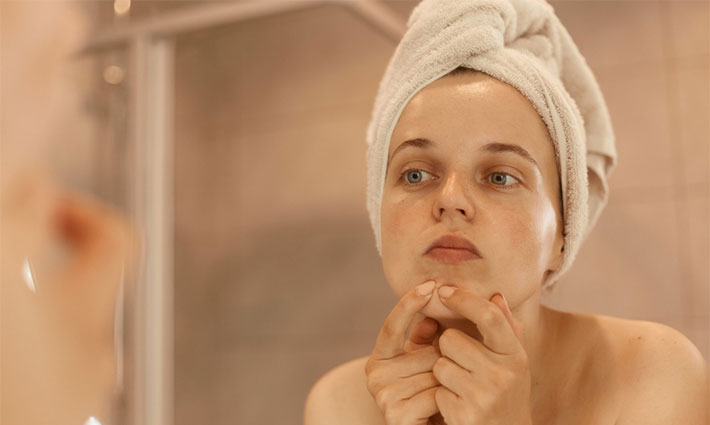 Hogyan alakulnak ki az eltömődött pórusok, és mit lehet tenni ellenük?