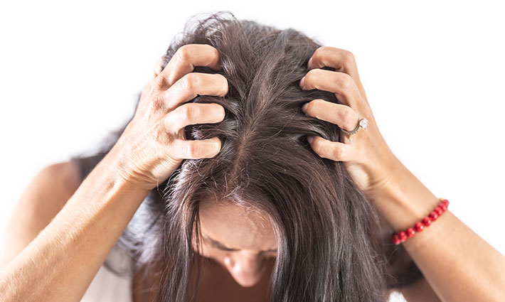 Mit tegyünk száraz fejbőr esetén? – A viszketés okai és a hatékony hidratálás módjai