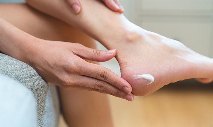 Berepedezett bőr a kezeken és a talpakon – Miért alakul ki, és mi segíthet?